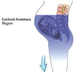 BIRTH and ANESTHESIA - Anesthesiology and Reanimation