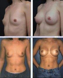 BODY CONTOURING - Plastic and Reconstructive Surgery