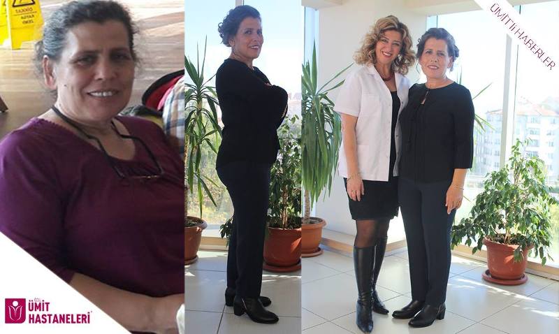 AKUPUNKTUR İLE 5 AYDA 20 KİLO VERDİ AKUPUNKTUR İLE 5 AYDA 20 KİLO VERDİ
