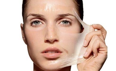 Kimyasal Peeling Kimyasal Peeling