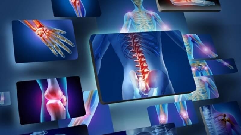 Onkolojik Rehabilitasyon Onkolojik Rehabilitasyon