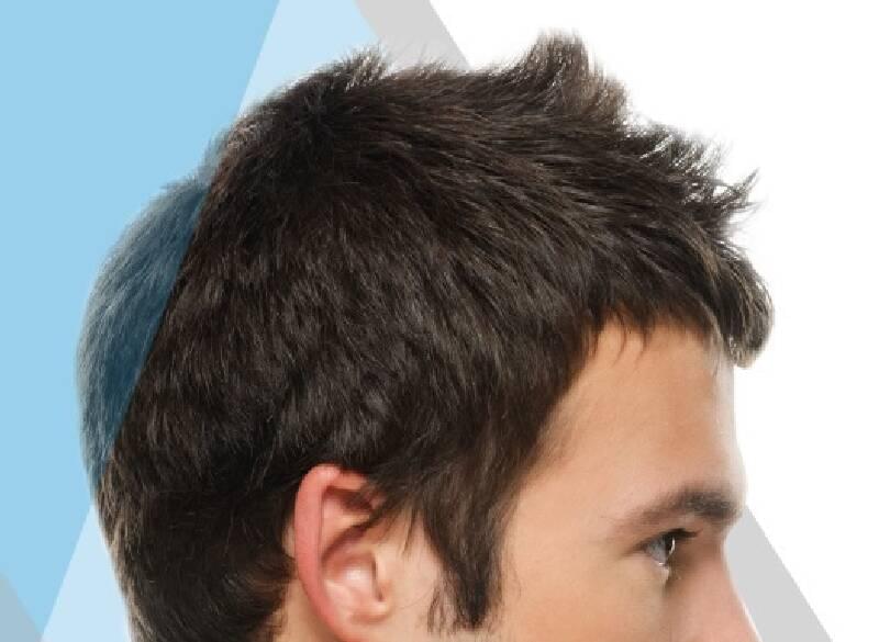 لا تصرف اموالك لكي تحصل لنتيجة سيئة في زراعة الشعر. لا تصرف اموالك لكي تحصل لنتيجة سيئة في زراعة الشعر.
