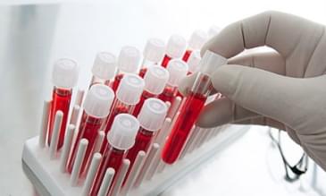 Hemofili Nedir ? Hemofili Nedir ?