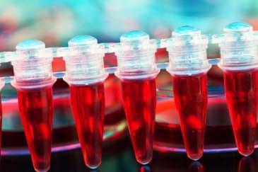 Hematoloji (Kan Hastalıkları) Hakkında Herşey Hematoloji (Kan Hastalıkları) Hakkında Herşey
