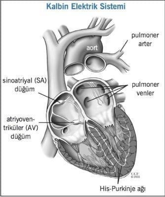 Atrial Fibrilasyon və Ablasyon Müalicəsi Nədir?