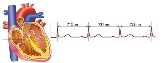 Dijital Check-Up (HRV)